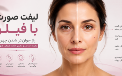 لیفت صورت با فیلر؛ راز جوان‌تر شدن چهره بدون جراحی و تغییر حالت طبیعی صورت