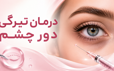 درمان تیرگی دور چشم؛ فیلر بهتر است یا جراحی؟