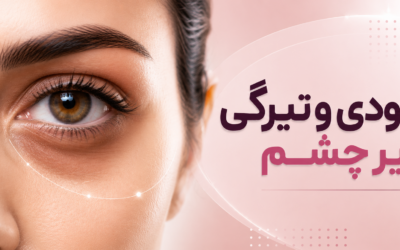 گودی و تیرگی زیر چشم؛ چرا برای همه یک درمان جواب نمی‌دهد؟