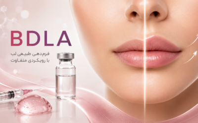 تکنیک BDLA؛ وقتی هدف فیلر لب، بزرگ‌تر شدن نیست