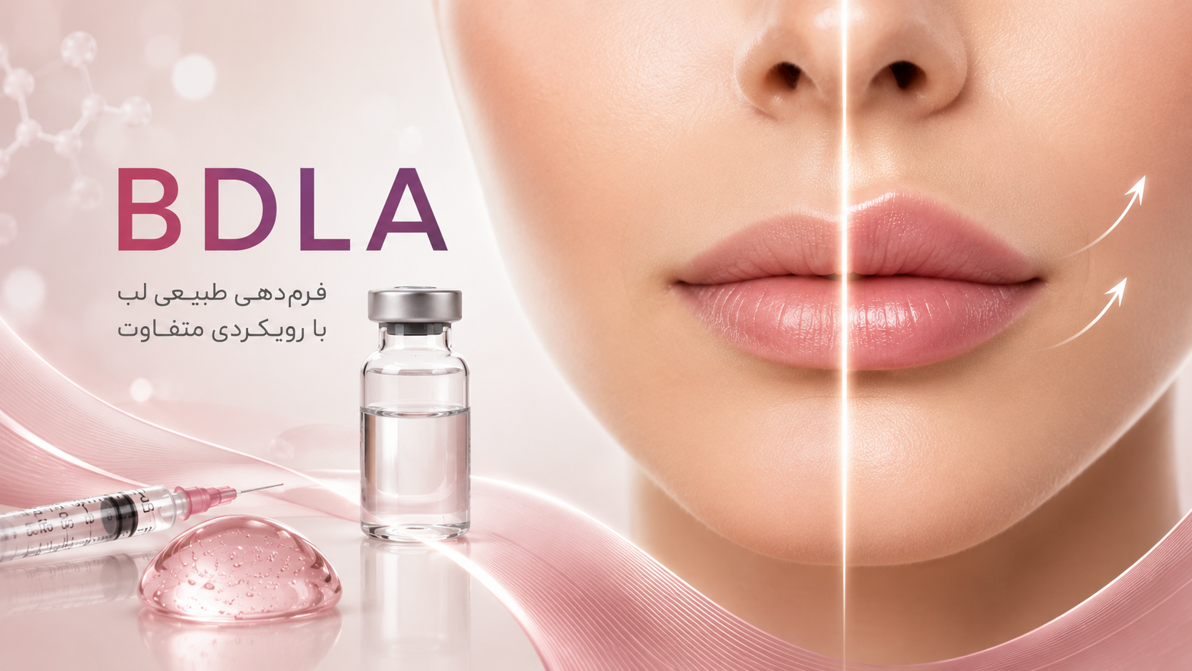 تکنیک BDLA؛ وقتی هدف فیلر لب، بزرگ‌تر شدن نیست