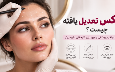 بوتاکس تعدیل یافته چیست؟ چرا نقاط تزریق نباید برای همه یکسان باشد؟