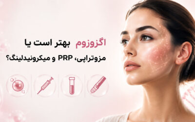 اگزوزوم بهتر است یا مزوتراپی، PRP و میکرونیدلینگ؟ مقایسه کامل بهترین روش‌های جوانسازی پوست