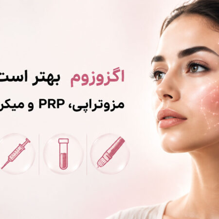 اگزوزوم بهتر است یا مزوتراپی، PRP و میکرونیدلینگ؟ مقایسه کامل بهترین روش‌های جوانسازی پوست
