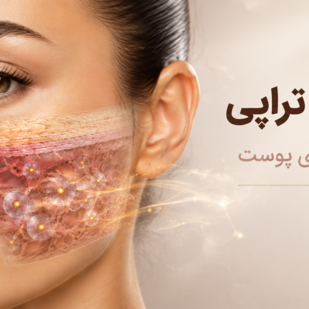 اگزوزوم تراپی چیست؟