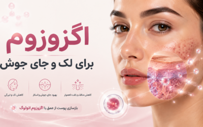 اگزوزوم برای لک، جای جوش و منافذ پوست چگونه عمل می‌کند؟