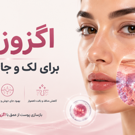 اگزوزوم برای لک و جای جوش