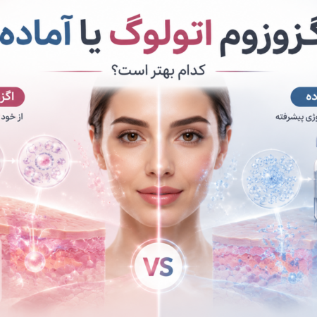 اگزوزوم اتولوگ یا اگزوزوم آماده؟
