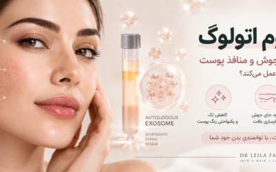 اگزوزوم اتولوگ برای پوست؛ چگونه به بهبود لک، جای جوش و منافذ کمک می‌کند؟