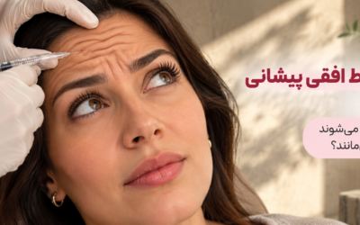 درمان خطوط افقی پیشانی با بوتاکس؛ کدام خطوط محو می‌شوند و کدام باقی می‌مانند؟