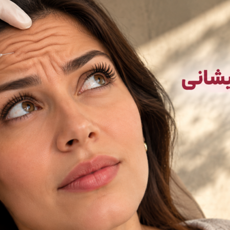 درمان خطوط افقی پیشانی با بوتاکس؛ کدام خطوط محو می‌شوند و کدام باقی می‌مانند؟