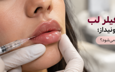 تخلیه و حل کردن فیلر لب با هیالورونیداز؛ چه زمانی لازم می‌شود؟
