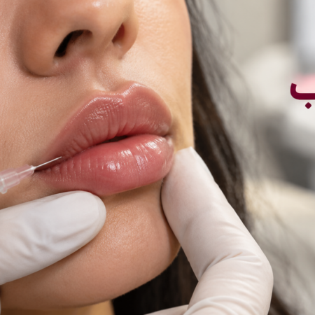 تخلیه و حل کردن فیلر لب با هیالورونیداز؛ چه زمانی لازم می‌شود؟