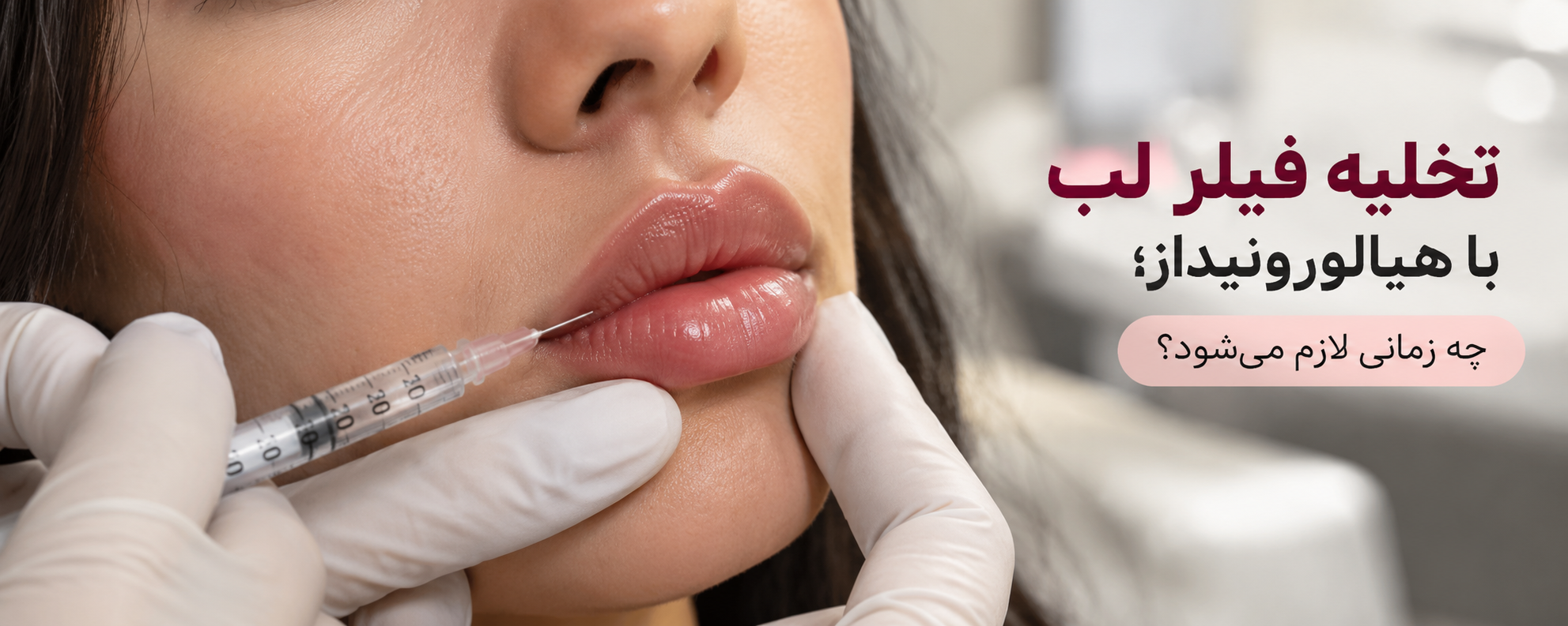 تخلیه و حل کردن فیلر لب با هیالورونیداز؛ چه زمانی لازم میشود؟