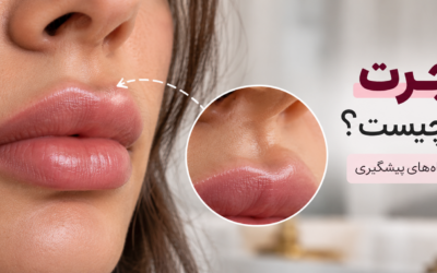 مهاجرت فیلر لب چیست؟ علت‌ها، نشانه‌ها و راه‌های پیشگیری