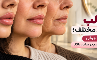 فیلر لب در سنین مختلف؛ از فرم‌دهی در جوانی تا بازگرداندن حجم در سنین بالاتر