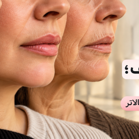 فیلر لب در سنین مختلف؛ از فرم‌دهی در جوانی تا بازگرداندن حجم در سنین بالاتر